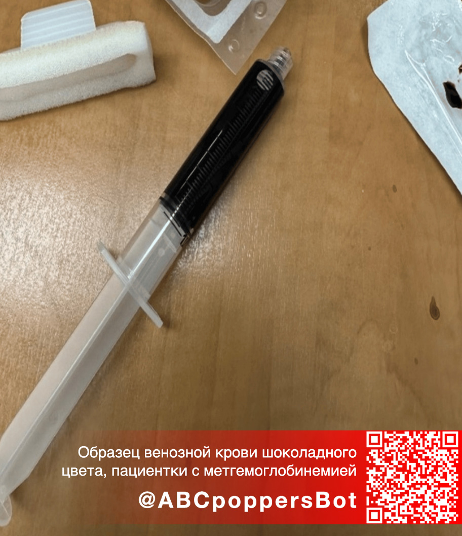 Если принять попперс внутрь в Новороссийске это вызывает метгемоглобинемию. Смертельное состояние Если принять попперс внутрь в Новороссийске это вызывает метгемоглобинемию. Смертельное состояние